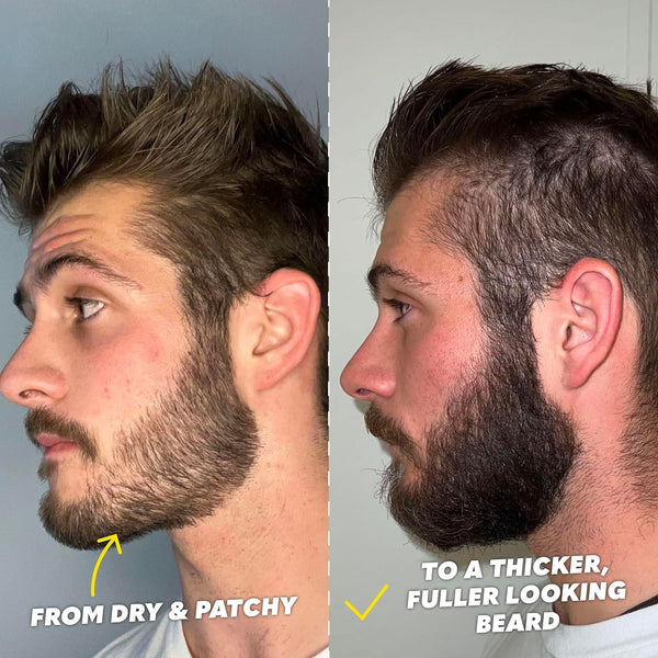 Ultimate Beard Growth Kit