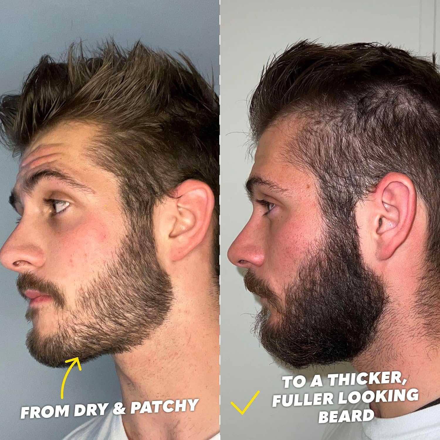 Ultimate Beard Growth Kit
